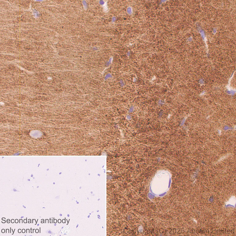Immunohistochemistry (Formalin/PFA-fixed paraffin-embedded sections) - Anti-Versican antibody [RM1301] (AB324605)