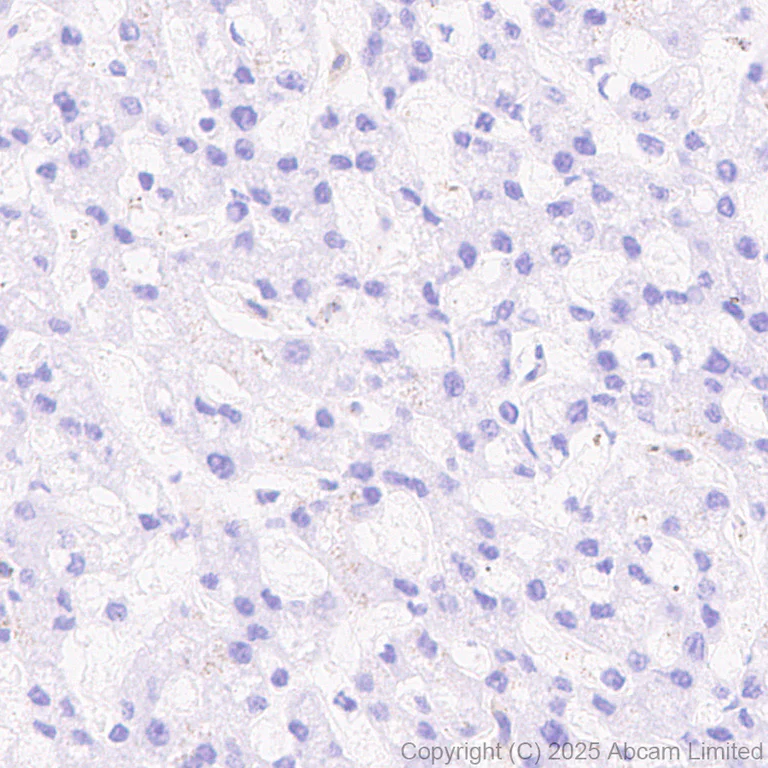Immunohistochemistry (Formalin/PFA-fixed paraffin-embedded sections) - Anti-Versican antibody [RM1301] (AB324605)