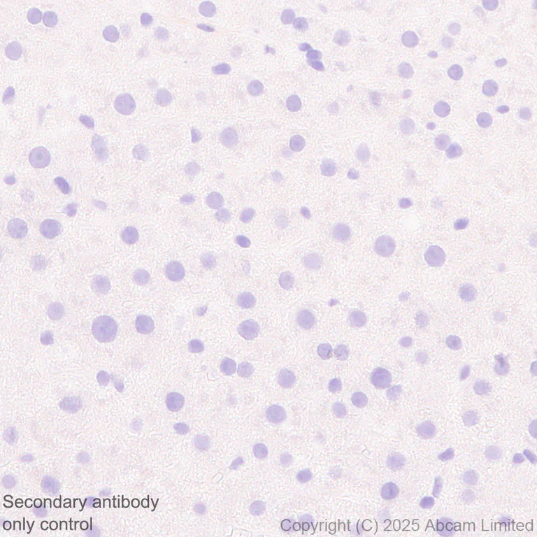 Immunohistochemistry (Formalin/PFA-fixed paraffin-embedded sections) - Anti-Versican antibody [RM1301] (AB324605)