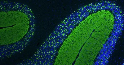 Immunohistochemistry (Formalin/PFA-fixed paraffin-embedded sections) - Anti-Vesicular glutamate transporter 1 antibody [N28/9] - Chicken IgY (Chimeric) (AB325671)