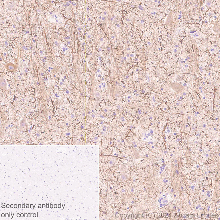 Immunohistochemistry (Formalin/PFA-fixed paraffin-embedded sections) - Anti-VGCNL1 antibody [EPR29666-91] (AB323186)