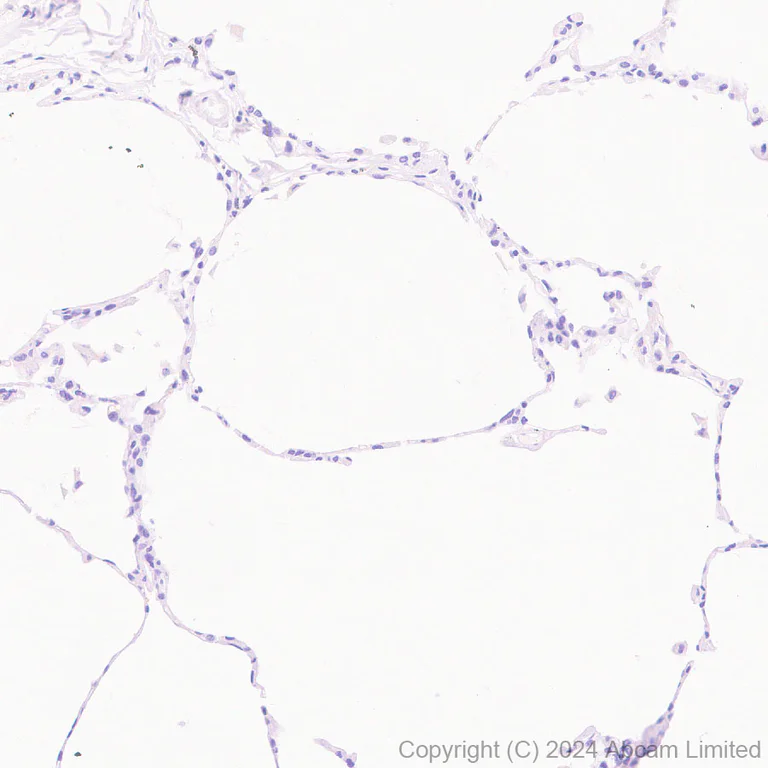 Immunohistochemistry (Formalin/PFA-fixed paraffin-embedded sections) - Anti-VGCNL1 antibody [EPR29666-91] (AB323186)