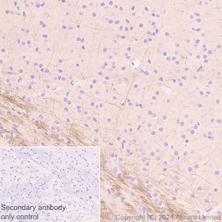 Immunohistochemistry (Formalin/PFA-fixed paraffin-embedded sections) - Anti-VGCNL1 antibody [EPR29666-91] (AB323186)