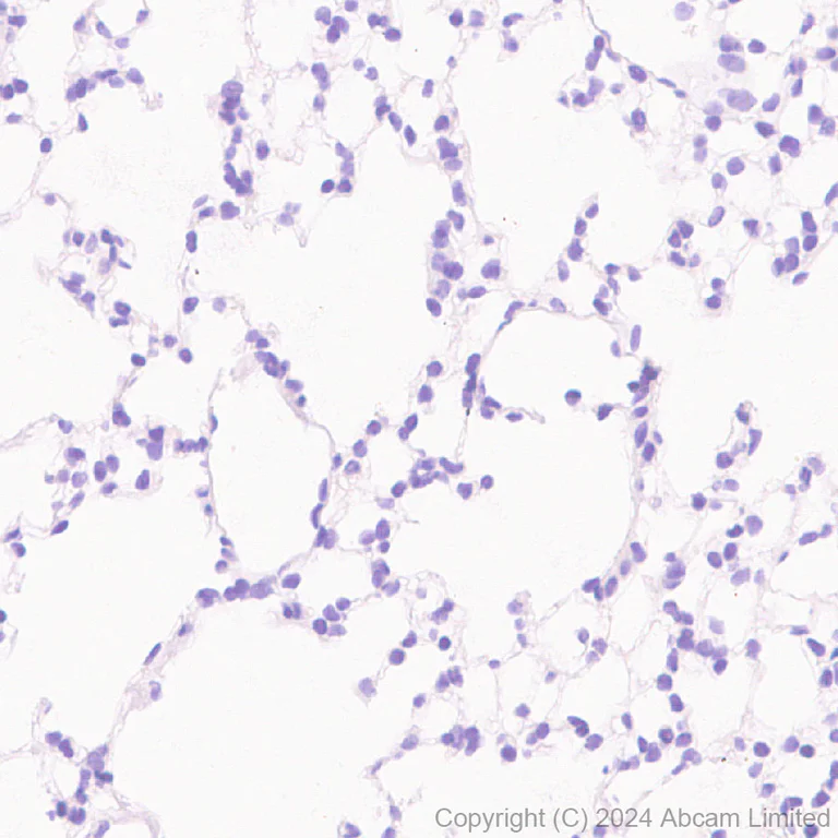 Immunohistochemistry (Formalin/PFA-fixed paraffin-embedded sections) - Anti-VGCNL1 antibody [EPR29666-91] (AB323186)