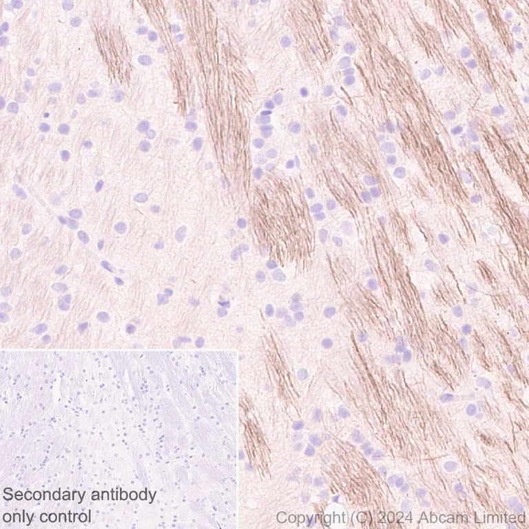 Immunohistochemistry (Formalin/PFA-fixed paraffin-embedded sections) - Anti-VGCNL1 antibody [EPR29666-91] (AB323186)