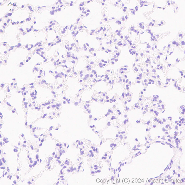 Immunohistochemistry (Formalin/PFA-fixed paraffin-embedded sections) - Anti-VGCNL1 antibody [EPR29666-91] (AB323186)