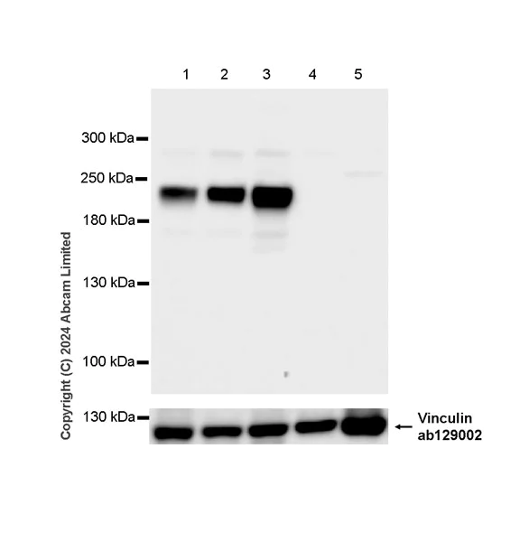 Western blot - Anti-VGCNL1 antibody [EPR29666-91] (AB323186)