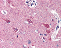 Immunohistochemistry (Formalin/PFA-fixed paraffin-embedded sections) - Anti-VGF antibody (AB115609), expandable thumbnail