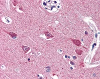 Immunohistochemistry (Formalin/PFA-fixed paraffin-embedded sections) - Anti-VGF antibody (AB115609)