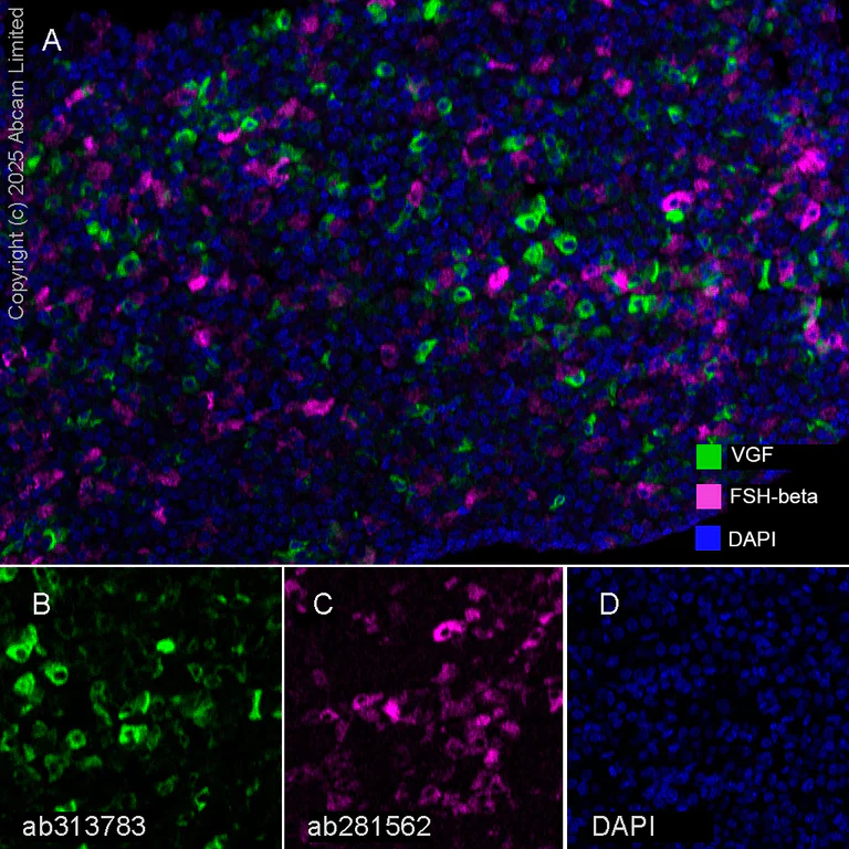 Multiplex immunohistochemistry - Anti-VGF antibody [EPR27029-60] (AB313783)