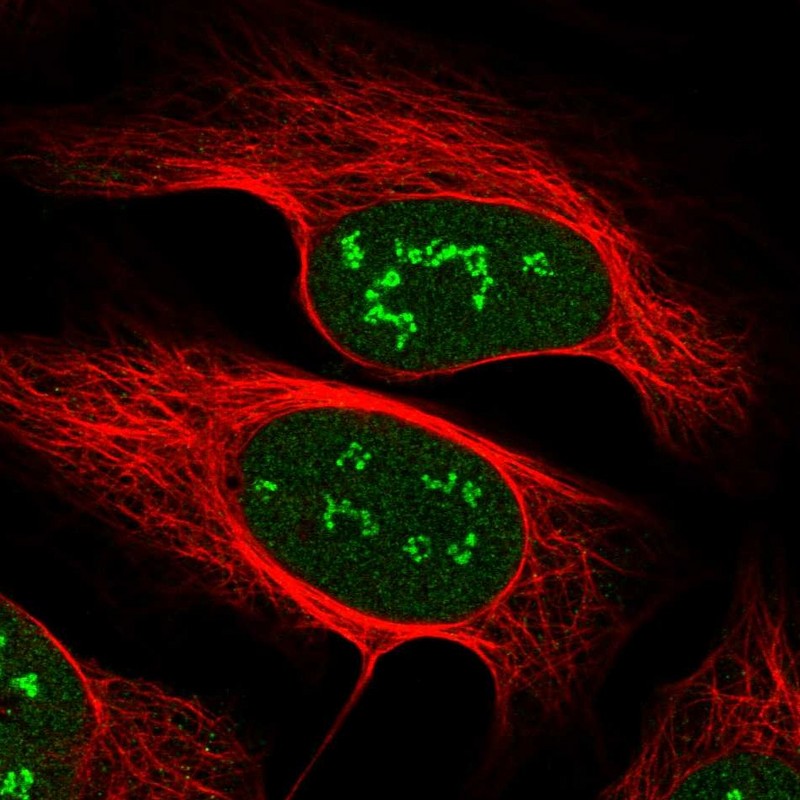 Immunocytochemistry/ Immunofluorescence - Anti-Vgl4 antibody (AB243518)