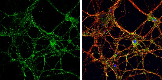 Immunocytochemistry/ Immunofluorescence - Anti-VGluT1 antibody (AB272913), expandable thumbnail