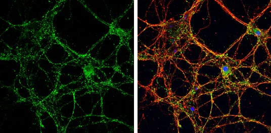 Immunocytochemistry/ Immunofluorescence - Anti-VGluT1 antibody (AB272913)