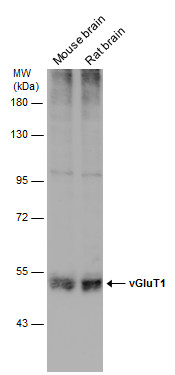 Western blot - Anti-VGluT1 antibody (AB272913), expandable thumbnail