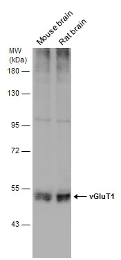 Western blot - Anti-VGluT1 antibody (AB272913)