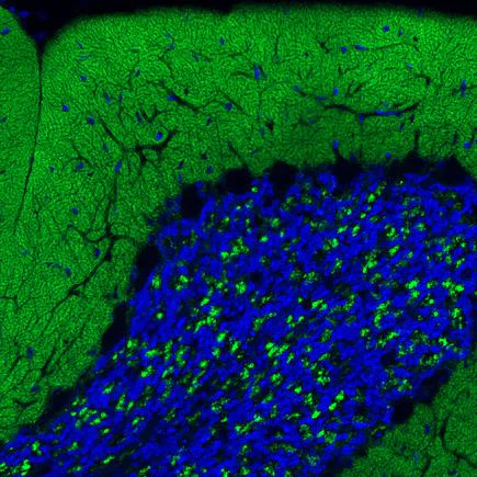 Immunohistochemistry (Formalin/PFA-fixed paraffin-embedded sections) - Anti-VGluT1 antibody [CL2754] (AB242204)