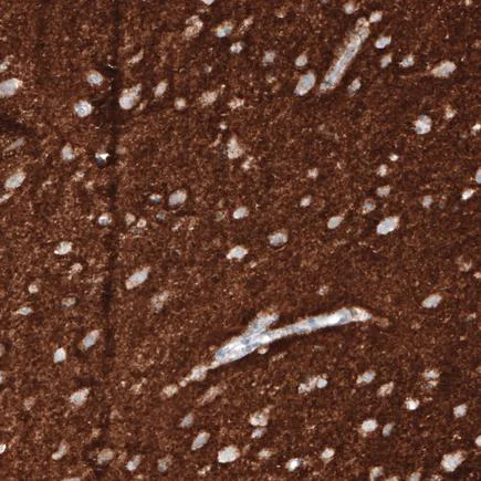 Immunohistochemistry (Formalin/PFA-fixed paraffin-embedded sections) - Anti-VGluT1 antibody [CL2754] (AB242204)