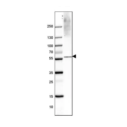 Western blot - Anti-VGluT1 antibody [CL2754] (AB242204)