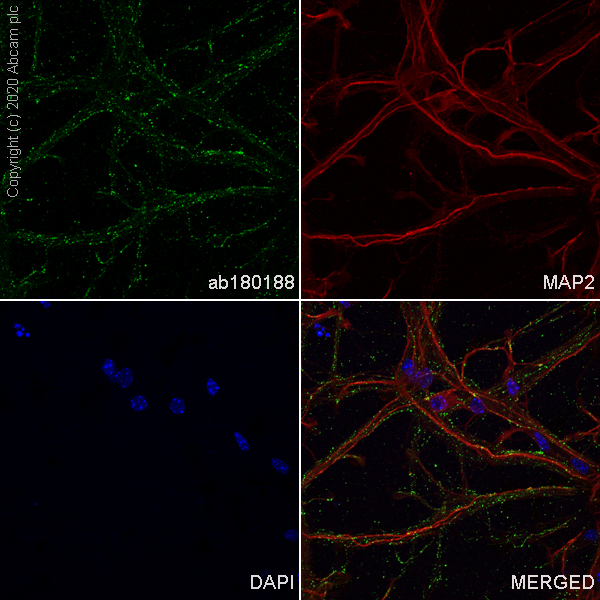 Immunocytochemistry/ Immunofluorescence - Anti-VGluT1 antibody [EPR10953] - BSA and Azide free (AB240224), expandable thumbnail