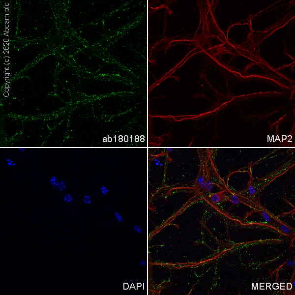 Immunocytochemistry/ Immunofluorescence - Anti-VGluT1 antibody [EPR10953] - BSA and Azide free (AB240224)