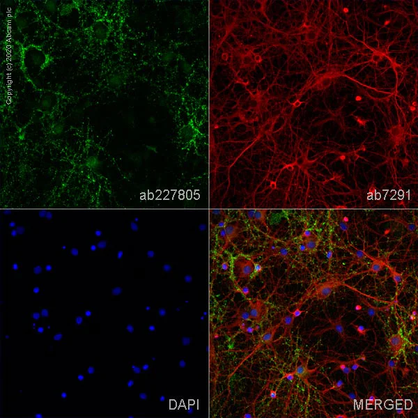 Immunocytochemistry/ Immunofluorescence - Anti-VGluT1 antibody [EPR22269] (AB227805)