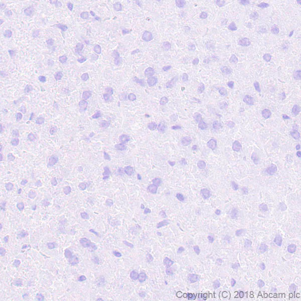 Immunohistochemistry (Formalin/PFA-fixed paraffin-embedded sections) - Anti-VGluT1 antibody [EPR22269] (AB227805)