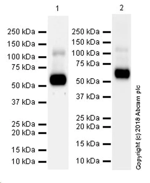 Western blot - Anti-VGluT1 antibody [EPR22269] (AB227805)