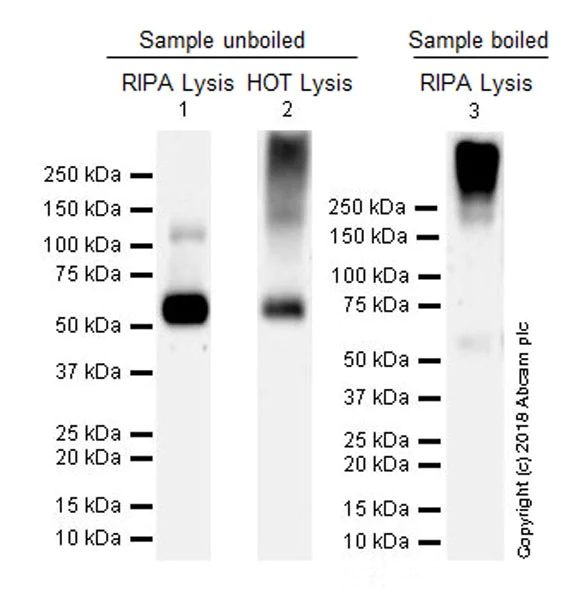 Western blot - Anti-VGluT1 antibody [EPR22269] (AB227805)