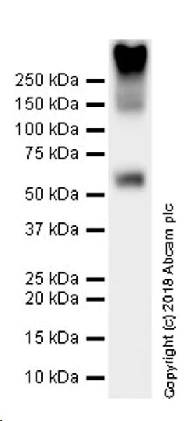 Western blot - Anti-VGluT1 antibody [EPR22269] (AB227805)