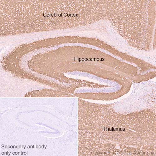 Immunohistochemistry (Formalin/PFA-fixed paraffin-embedded sections) - Anti-VGluT1 antibody [EPR22269] - BSA and Azide free (AB242017)