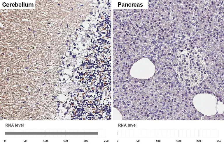 Immunohistochemistry (Formalin/PFA-fixed paraffin-embedded sections) - Anti-VGluT1 antibody [HL4544] - BSA and Azide free (AB327596)