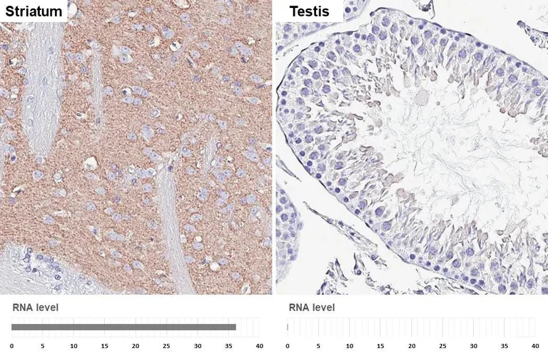 Immunohistochemistry (Formalin/PFA-fixed paraffin-embedded sections) - Anti-VGluT1 antibody [HL4544] - BSA and Azide free (AB327596)