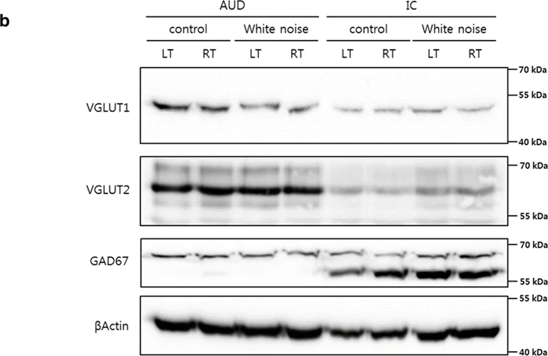 Western blot - Anti-VGLUT2 antibody [8G9.2] (AB79157)