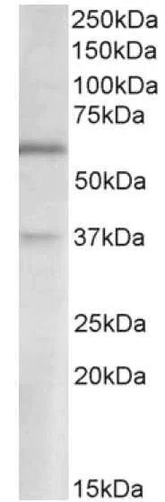 Western blot - Anti-VGLUT2 antibody (AB178538)