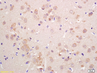 Immunohistochemistry (Formalin/PFA-fixed paraffin-embedded sections) - Anti-VGLUT2 antibody (AB217943)
