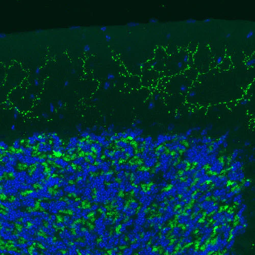Immunohistochemistry (Formalin/PFA-fixed paraffin-embedded sections) - Anti-VGLUT2 antibody [CL2921] (AB211869)