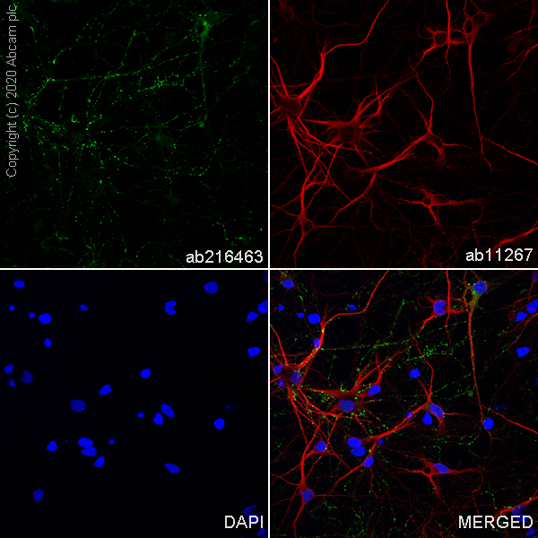 Immunocytochemistry/ Immunofluorescence - Anti-VGLUT2 antibody [EPR21085] (AB216463), expandable thumbnail