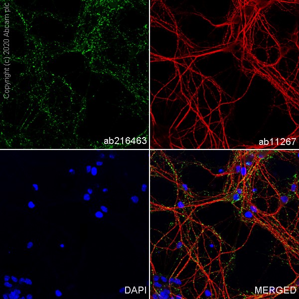 Immunocytochemistry/ Immunofluorescence - Anti-VGLUT2 antibody [EPR21085] (AB216463), expandable thumbnail