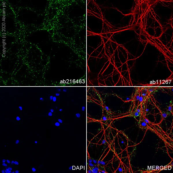 Immunocytochemistry/ Immunofluorescence - Anti-VGLUT2 antibody [EPR21085] (AB216463)