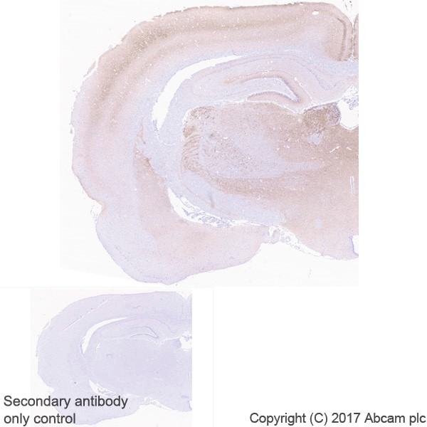 Immunohistochemistry (Formalin/PFA-fixed paraffin-embedded sections) - Anti-VGLUT2 antibody [EPR21085] (ab216463), expandable thumbnail