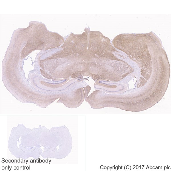 Immunohistochemistry (Formalin/PFA-fixed paraffin-embedded sections) - Anti-VGLUT2 antibody [EPR21085] (ab216463), expandable thumbnail