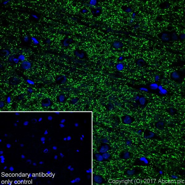 Immunohistochemistry (Frozen sections) - Anti-VGLUT2 antibody [EPR21085] (ab216463), expandable thumbnail