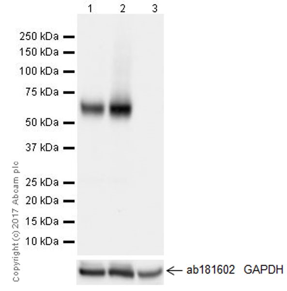 Western blot - Anti-VGLUT2 antibody [EPR21085] (ab216463), expandable thumbnail