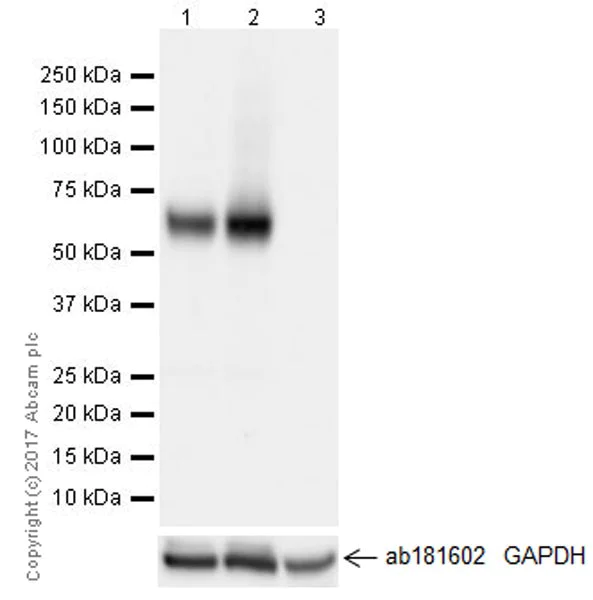 Western blot - Anti-VGLUT2 antibody [EPR21085] (AB216463)
