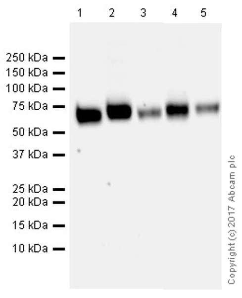 Western blot - Anti-VGLUT2 antibody [EPR21085] (AB216463)