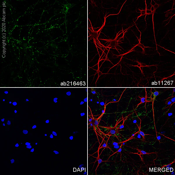 Immunocytochemistry/ Immunofluorescence - Anti-VGLUT2 antibody [EPR21085] - BSA and Azide free (AB227906)
