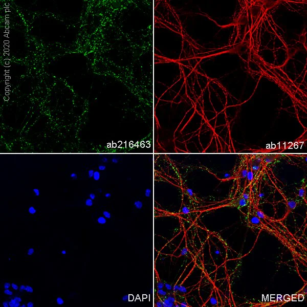 Immunocytochemistry/ Immunofluorescence - Anti-VGLUT2 antibody [EPR21085] - BSA and Azide free (AB227906)