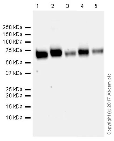 Western blot - Anti-VGLUT2 antibody [EPR21085] - BSA and Azide free (AB227906)