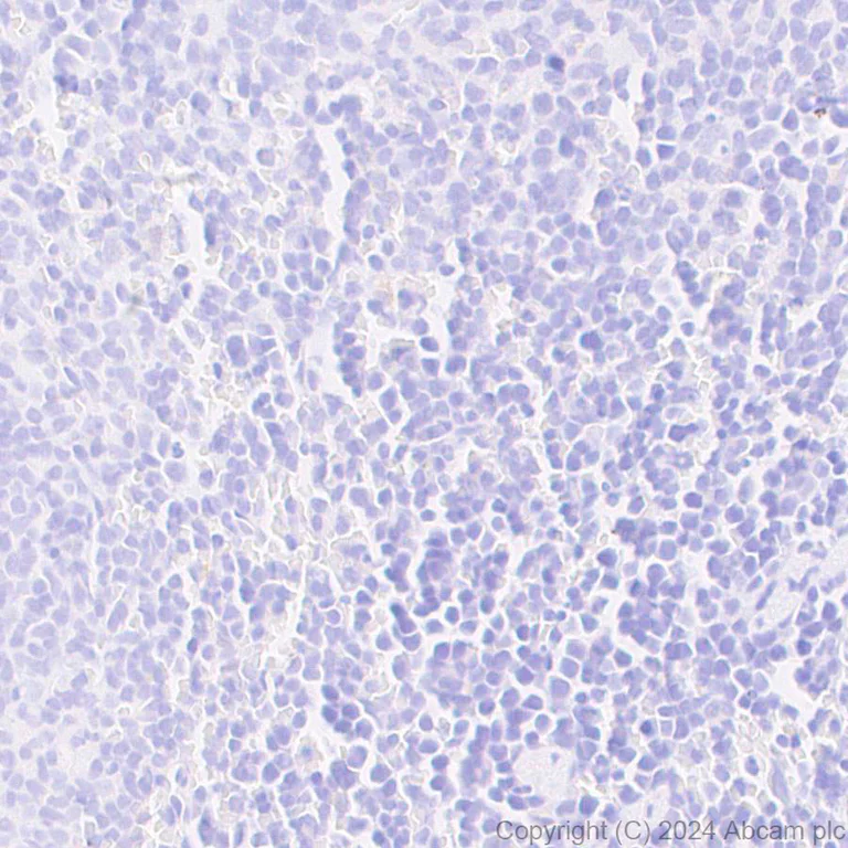 Immunohistochemistry (Formalin/PFA-fixed paraffin-embedded sections) - Anti-VGLUT3 antibody [EPR28534-165] - BSA and Azide free (AB316323)