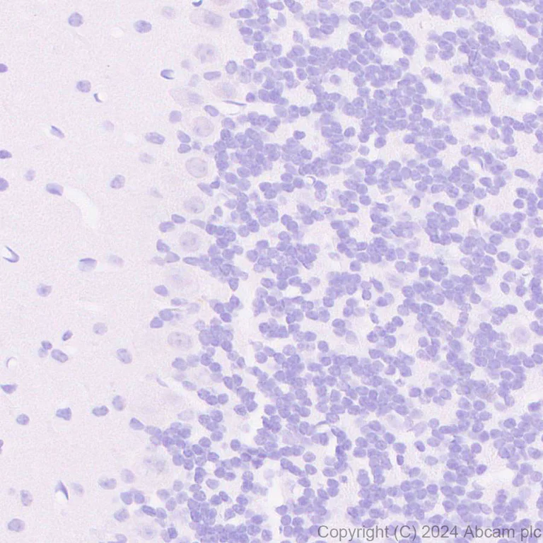 Immunohistochemistry (Formalin/PFA-fixed paraffin-embedded sections) - Anti-VGLUT3 antibody [EPR28534-165] - BSA and Azide free (AB316323)